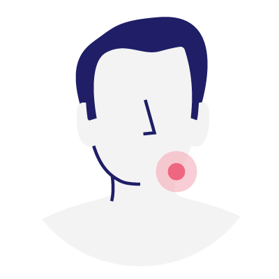 Debiopharm-Trial-Head and neck cancer