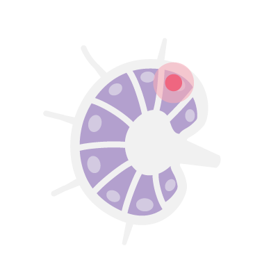 Debiopharm-Trial-Non Hodgkin lymphoma